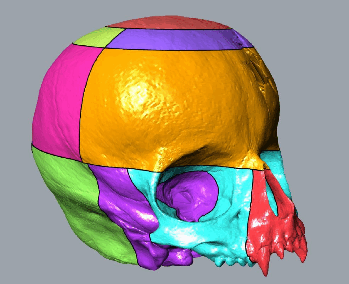 A colorful 3D model of a human skull showing segmented areas.